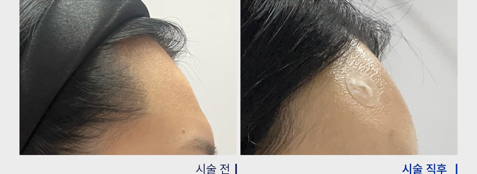 전후사진