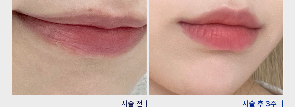 전후사진