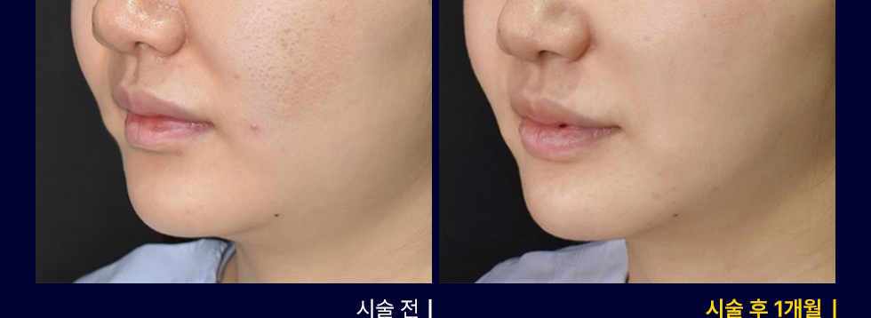 전후사진