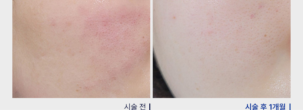 전후사진
