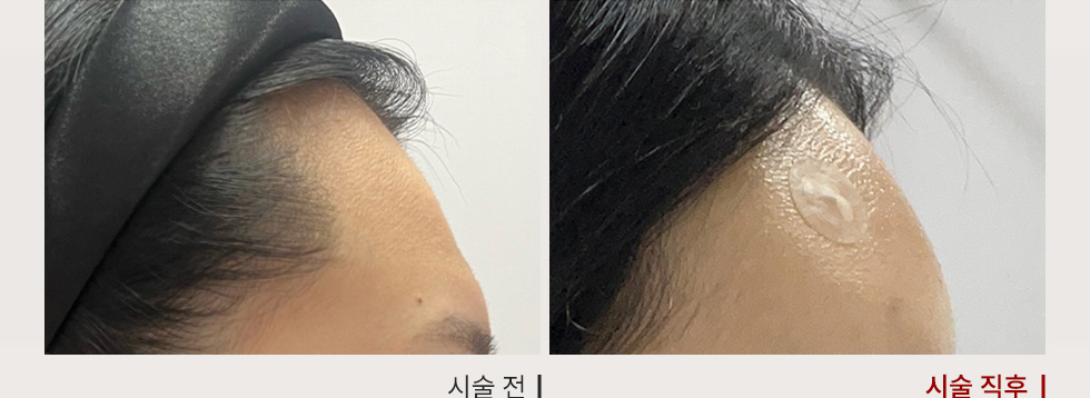 전후사진