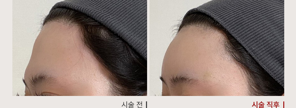 전후사진