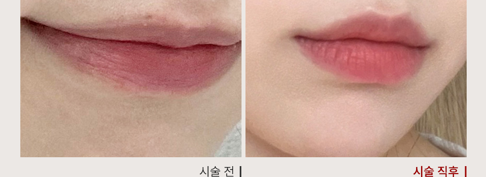 전후사진