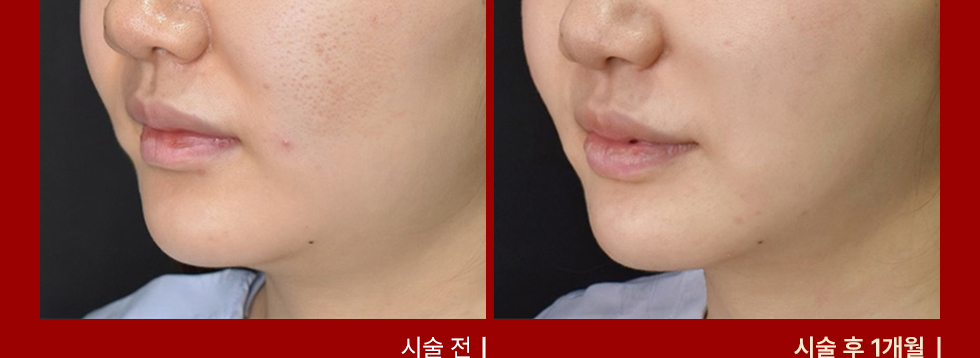 전후사진