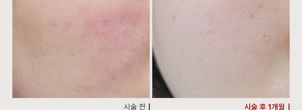 전후사진
