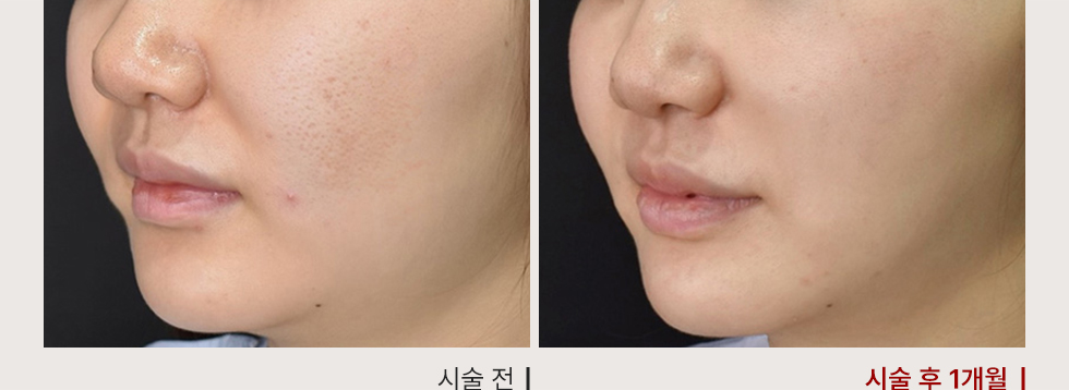 전후사진