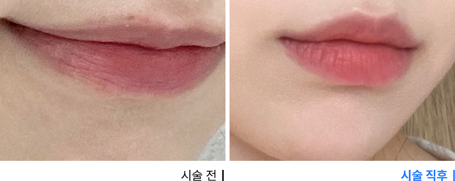 전후사진