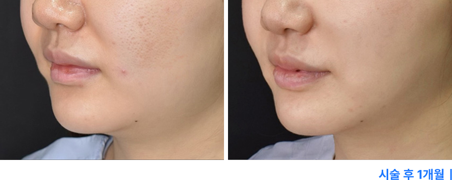 전후사진