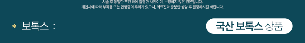 국산 보톡스 상품