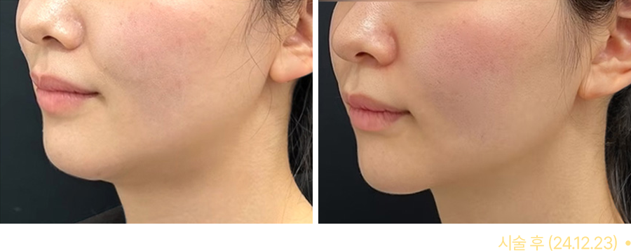 전후사진