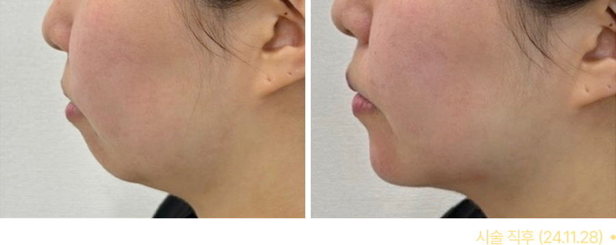 전후사진