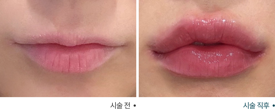 전후사진