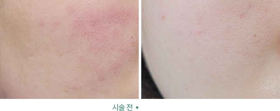 전후사진