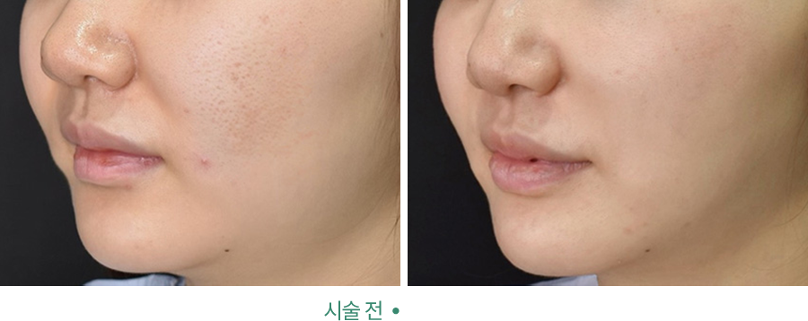 전후사진
